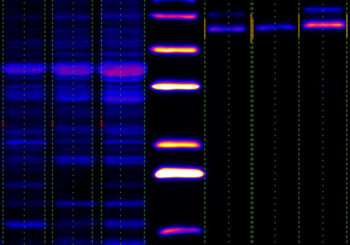 Published Protocol: Simple Analysis of Gel Images With IOCBIO Gel Software