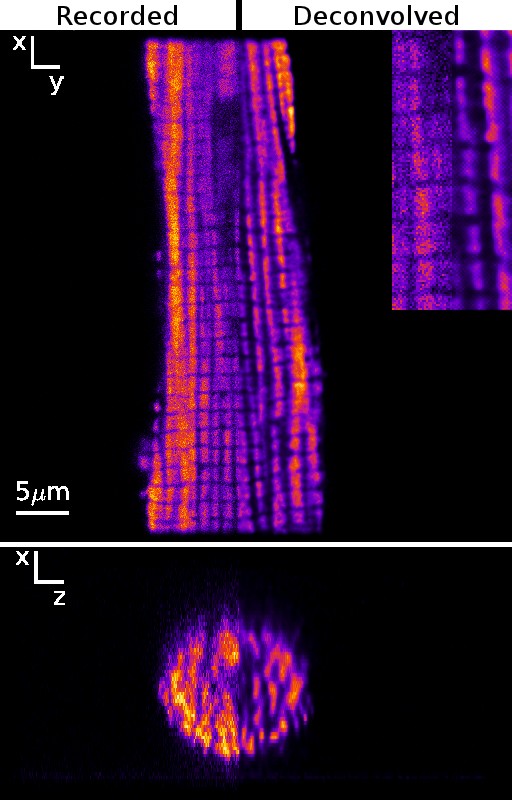 Application of regularized Richardson-Lucy algorithm for deconvolution of confocal microscopy images