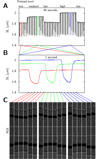 Real-time determination of sarcomere length of a single cardiomyocyte during contraction
